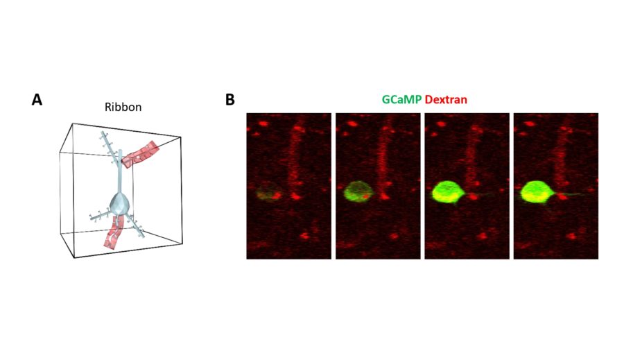 microscopio a 2 fotoni, neuroscienze, cervello