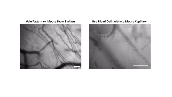 #neuroscienze #cervello #greenlight #ricerca #fluorescenza #invivo