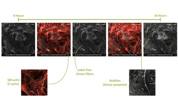 ctoscheleto, nanolive, live-cell, label-fee, imaging