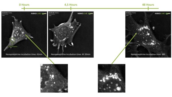 nanolive, noradrenalna, neurtrasmettitore, cervell, neurni, olotomografi, live-imaging, label-free