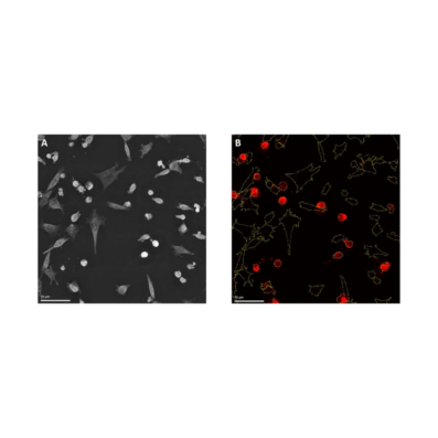Analisi cellulare con il nuovo modulo LCA di Nanolive, che integra imaging label-free e fluorescenza per esperimenti avanzati.