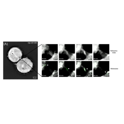 Imaging di mitocondri e nanotubi con FEMTO 3D ATLAS e olotomografia Nanolive.