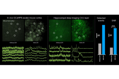 deep functional imaging con FEMTO 3D ATLAS