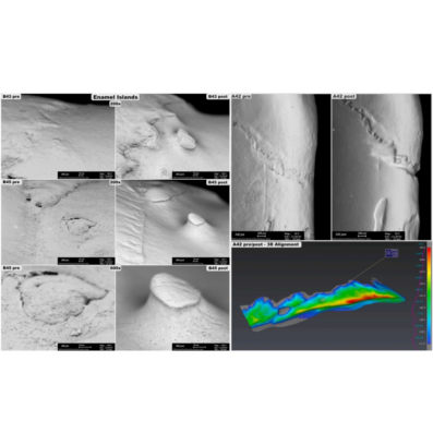 Usura cervicale dei denti studiata con SEM e modellizzazione 3D.