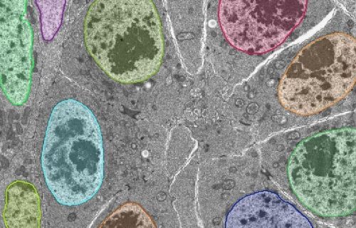media cybernetics, mediacy, immagini, elaborazione di immagini, scienze dei materiali, scienze della vita, microscopia, imaging, AI, IA, Intelligenza artificiale, Machine learning