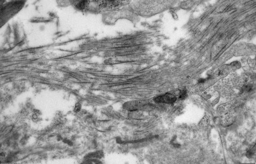 Tissue_Liver_Qedira_2900x_04_1